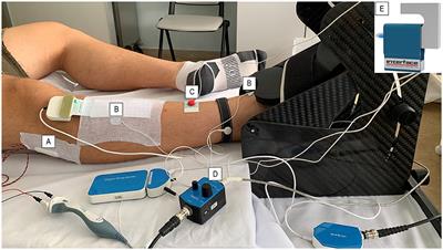 Electrophysiological neuromuscular alterations and severe fatigue predict long-term muscle weakness in survivors of COVID-19 acute respiratory distress syndrome